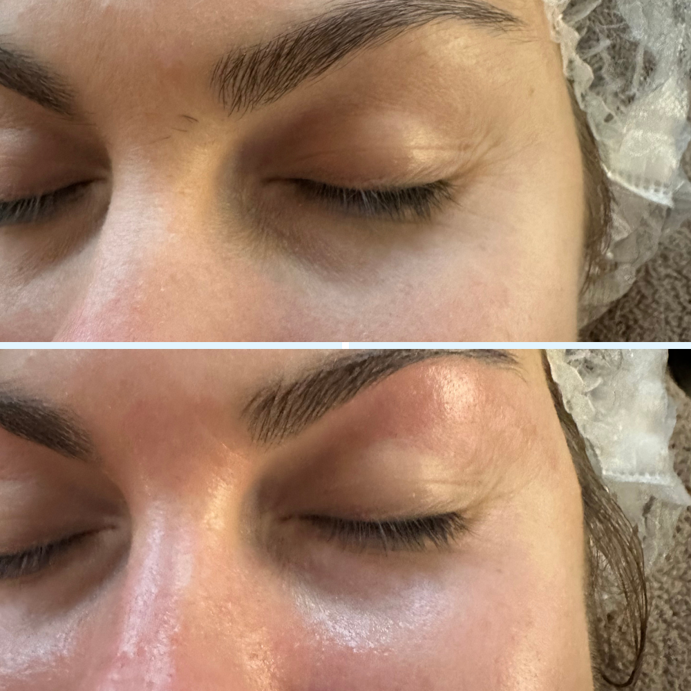 Firm & Glow Eye Patches - I'm Emmagen