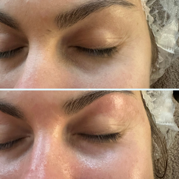 Firm & Glow Eye Patches - I'm Emmagen