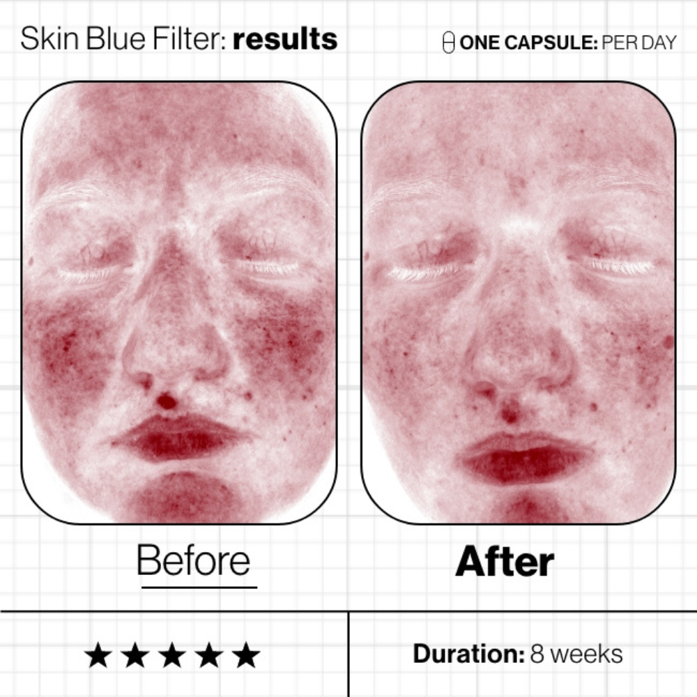 Skin Blue Filter - Advanced Nutrition Programme - pure skin - voor en na resultaten roodheden