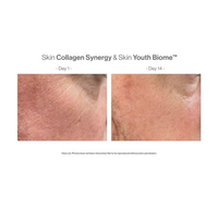 Skin collagen synergy- advanced nutrition programme - huidsupplementen webshop kopen - resultaten - voor en na